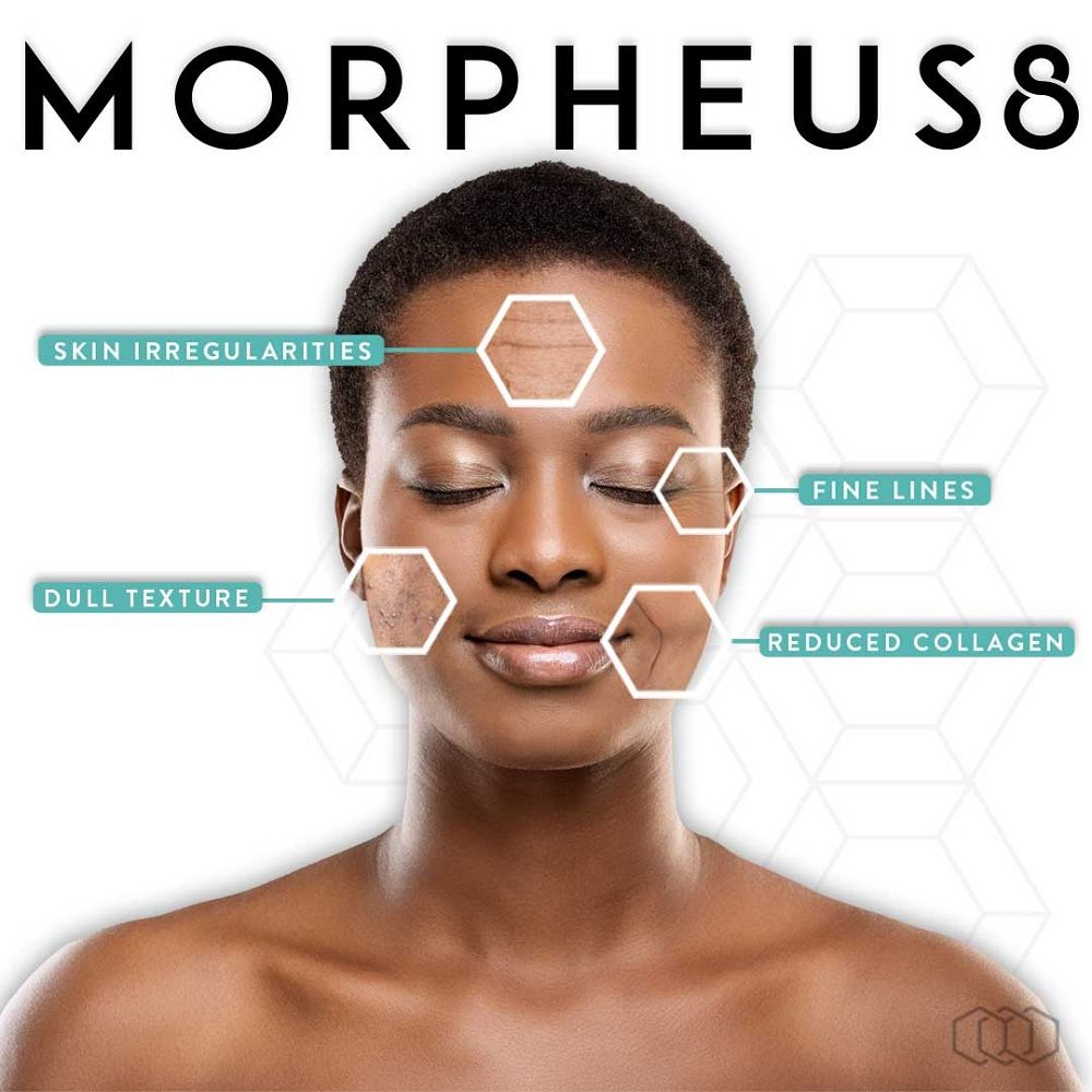 Minimally Invasive Facial and Body Fractional Remodeling with MORPHEUS8!