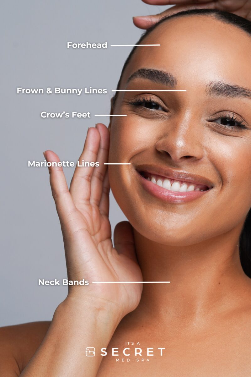 Botox® Treatment Areas