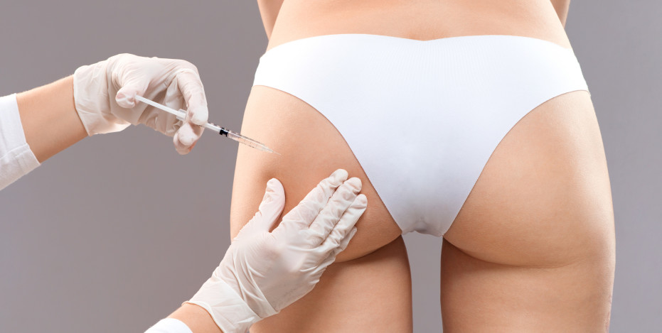 Sculptra Butt Lifting Concept. Slim Woman Having Hip Injection At Beauty Salon, Closeup. Plastic Surgery