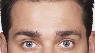 Male After Botox Photo